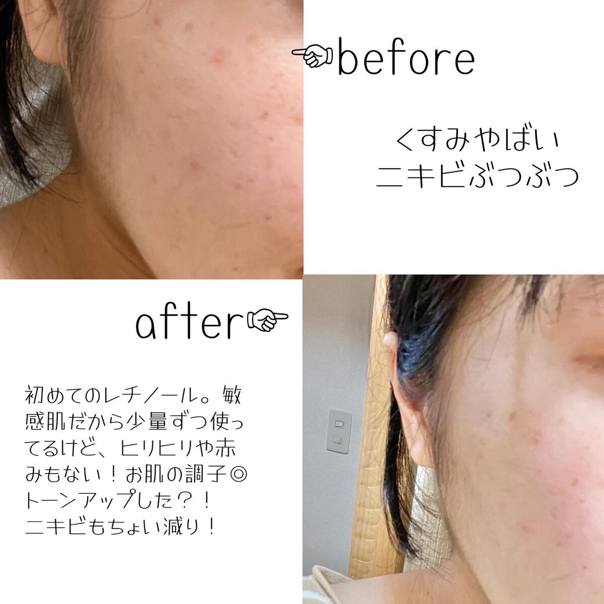 CICA クリーム/VT/フェイスクリームを使ったクチコミ(5枚目)