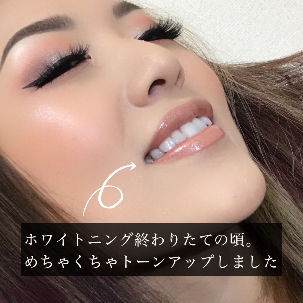 ホワイトニングペースト/Smile Cosmetique/歯磨き粉を使ったクチコミ（3枚目）