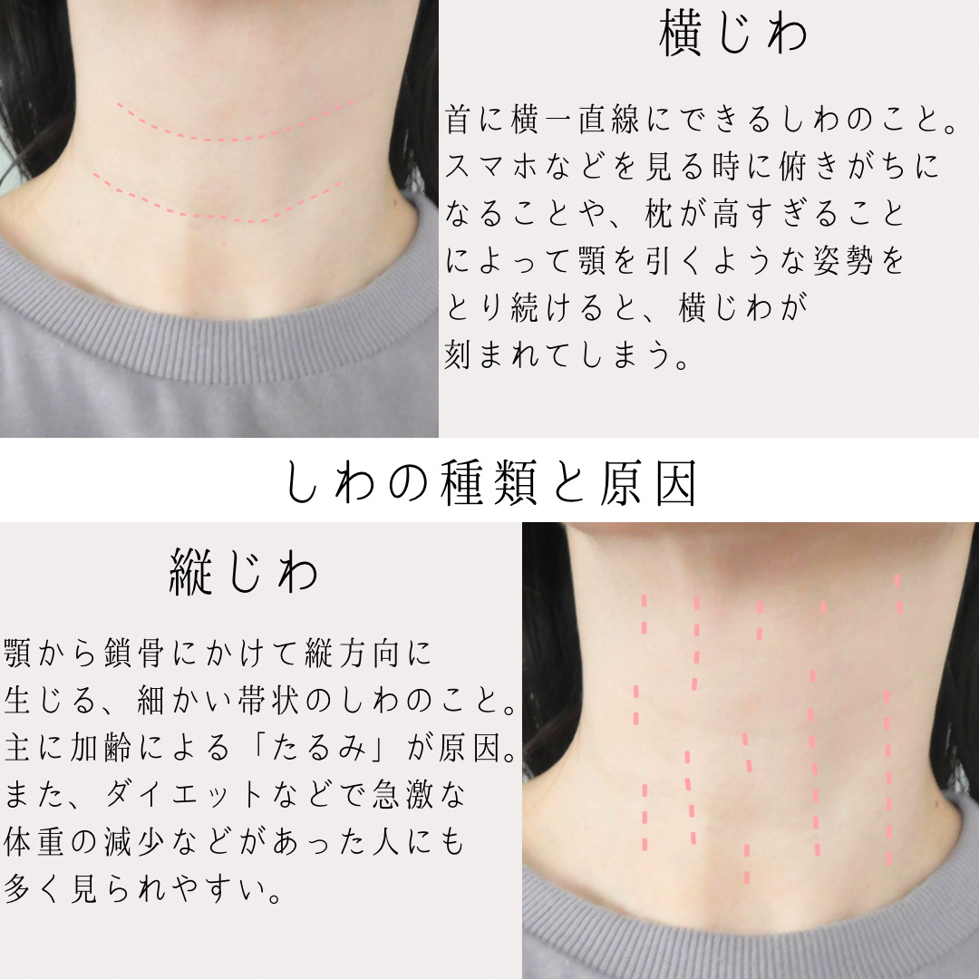 レチノールトナー/APLIN/ミスト状化粧水を使ったクチコミ（3枚目）