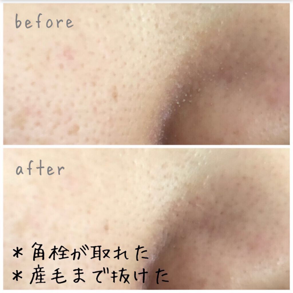 ももぷり フレッシュバブルパック/ももぷり/洗い流すパック・マスクを使ったクチコミ（3枚目）