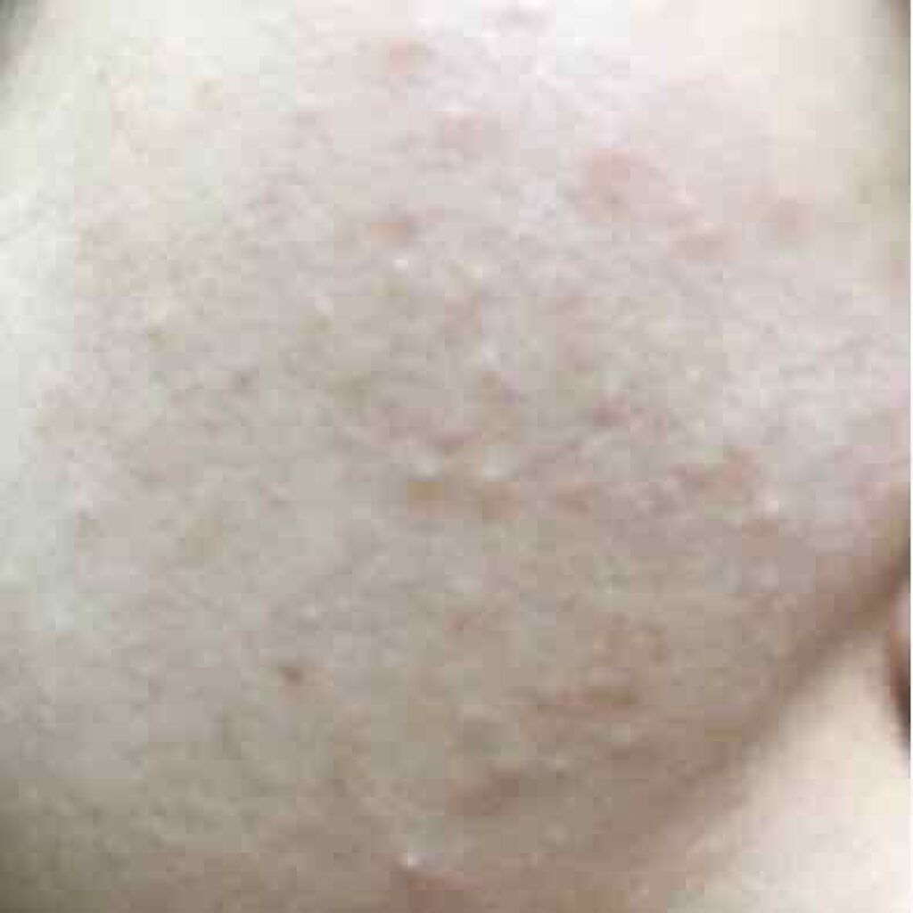 ザ・タイムR アクア/IPSA/化粧水を使ったクチコミ(3枚目)