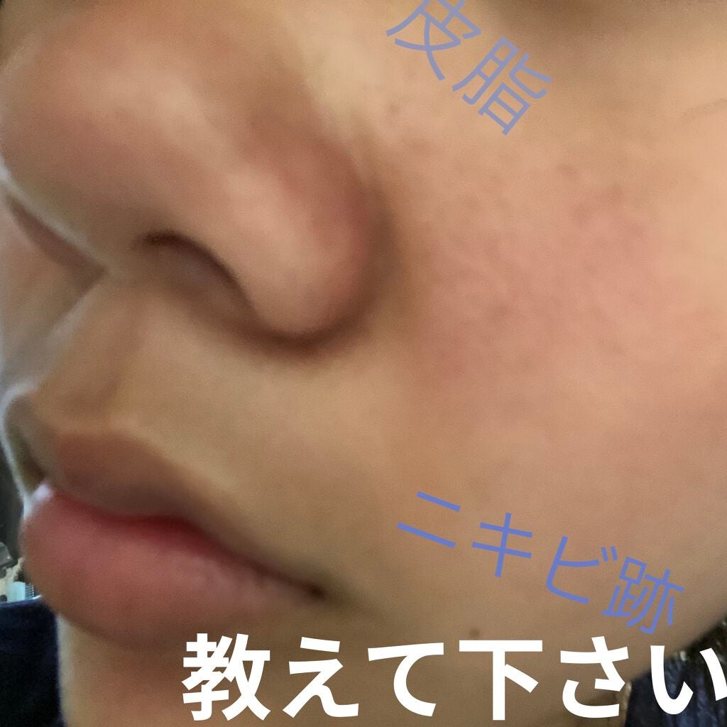 ハトムギ化粧水(ナチュリエ スキンコンディショナー R )/ナチュリエ/化粧水を使ったクチコミ(1枚目)