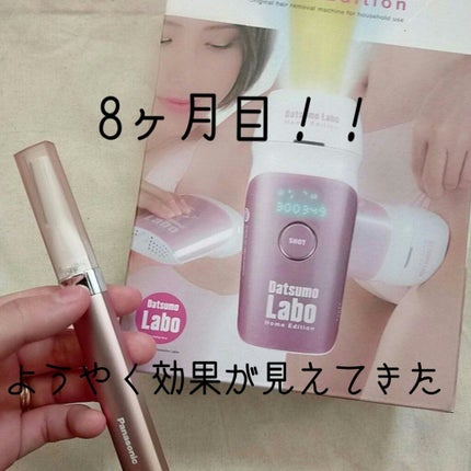 脱毛ラボ ホームエディション/脱毛ラボ/家庭用脱毛器を使ったクチコミ(1枚目)