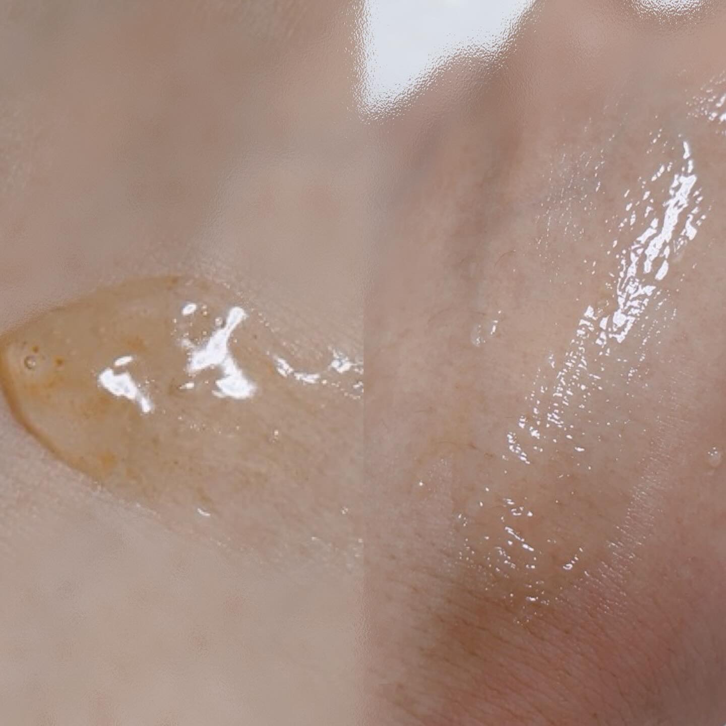 アスタリライズV3エッセンス/アトレージュ AD＋/美容液を使ったクチコミ（3枚目）