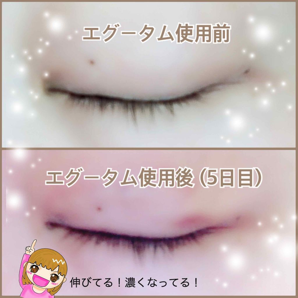 エグータム/アルマダスタイル/まつげ美容液を使ったクチコミ（2枚目）