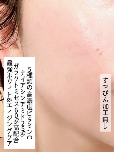 クオリティファースト ウルセラC ホワイトのクチコミ「価格がバグってるでお馴染みの DERMA LASER ULTHERA CW ダーマレーザー ウ.....」（3枚目）