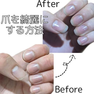 ネイルベッドオイル アンドネイルの口コミ 爪を伸ばしたい ネイルベッドを伸ばしたい方 By Nini 30 混合肌 10代前半 Lips