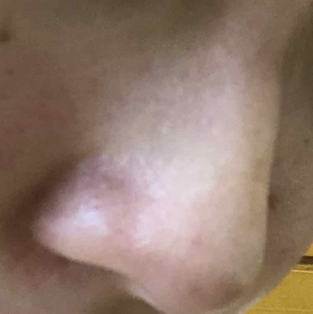 デュオ ザ クレンジングバーム/DUO/クレンジングバームを使ったクチコミ(4枚目)