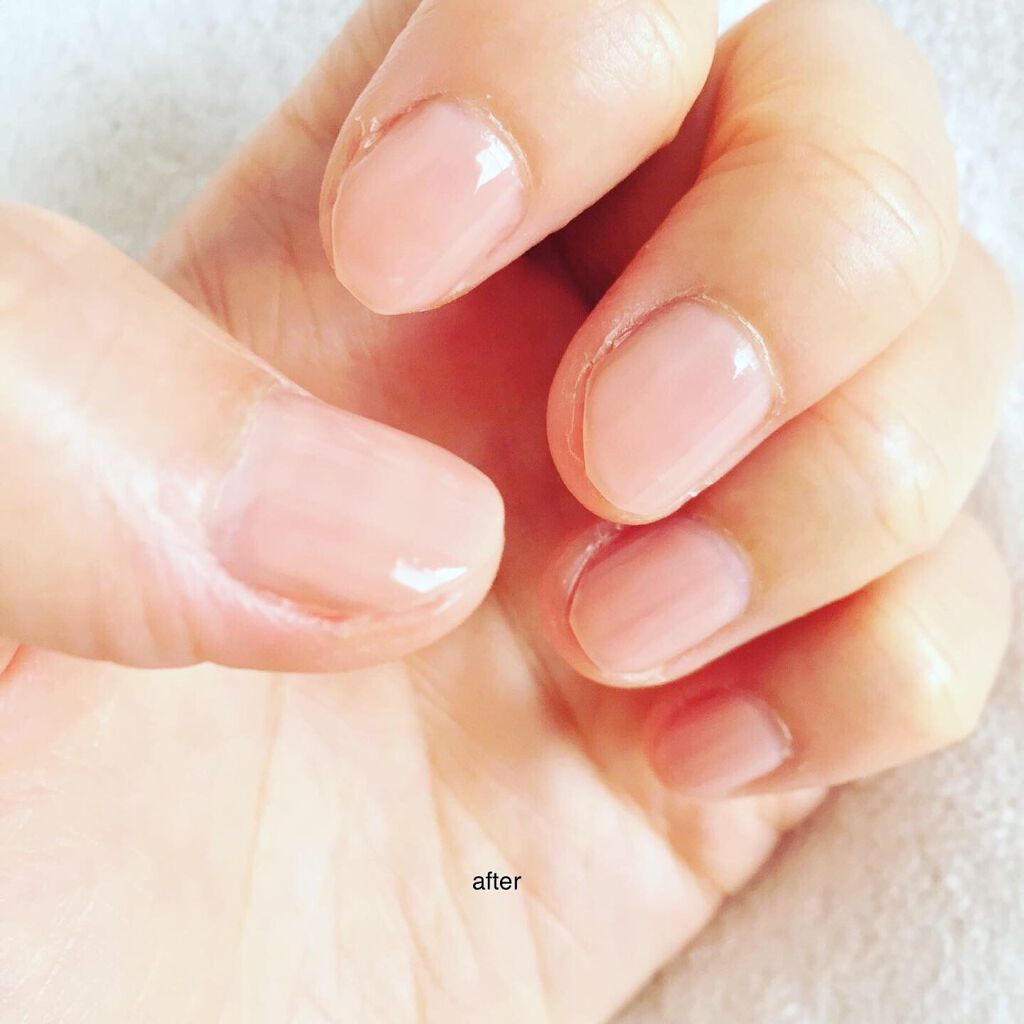 ファイブインワンケアコート/ネイリスト/オールインワンネイルを使ったクチコミ（3枚目）