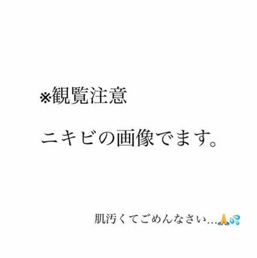 ちふれ ボラージ ミルクのクチコミ「𓂃𓈒𓏸


ちふれ

ボラージクリーム VS ボラージミルク


3ヶ月くらい前に
ボラージク.....」（2枚目）