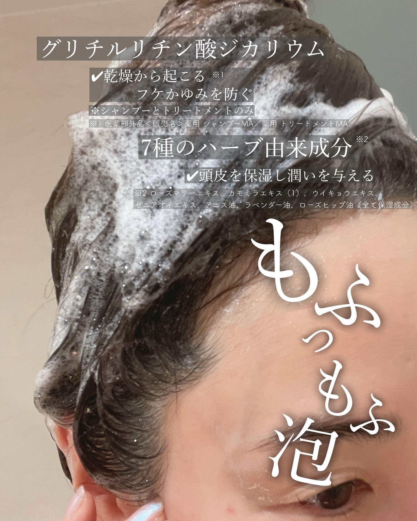 薬用スカルプケアシャンプー/トリートメント モイスト/WELLP/市販シャンプーを使ったクチコミ（2枚目）