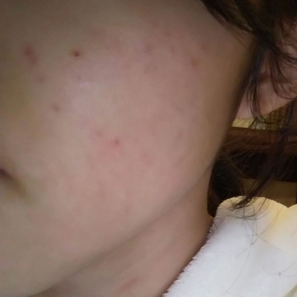 レチノール　シカ　リペア　セラム/innisfree/美容液を使ったクチコミ（1枚目）