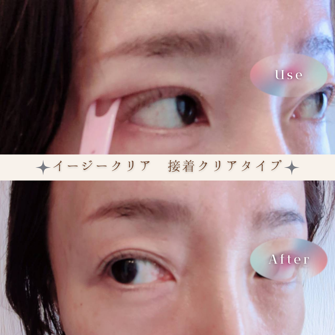 メザイク イージークリア 接着クリアタイプ/メザイク/二重まぶた用アイテムを使ったクチコミ（3枚目）
