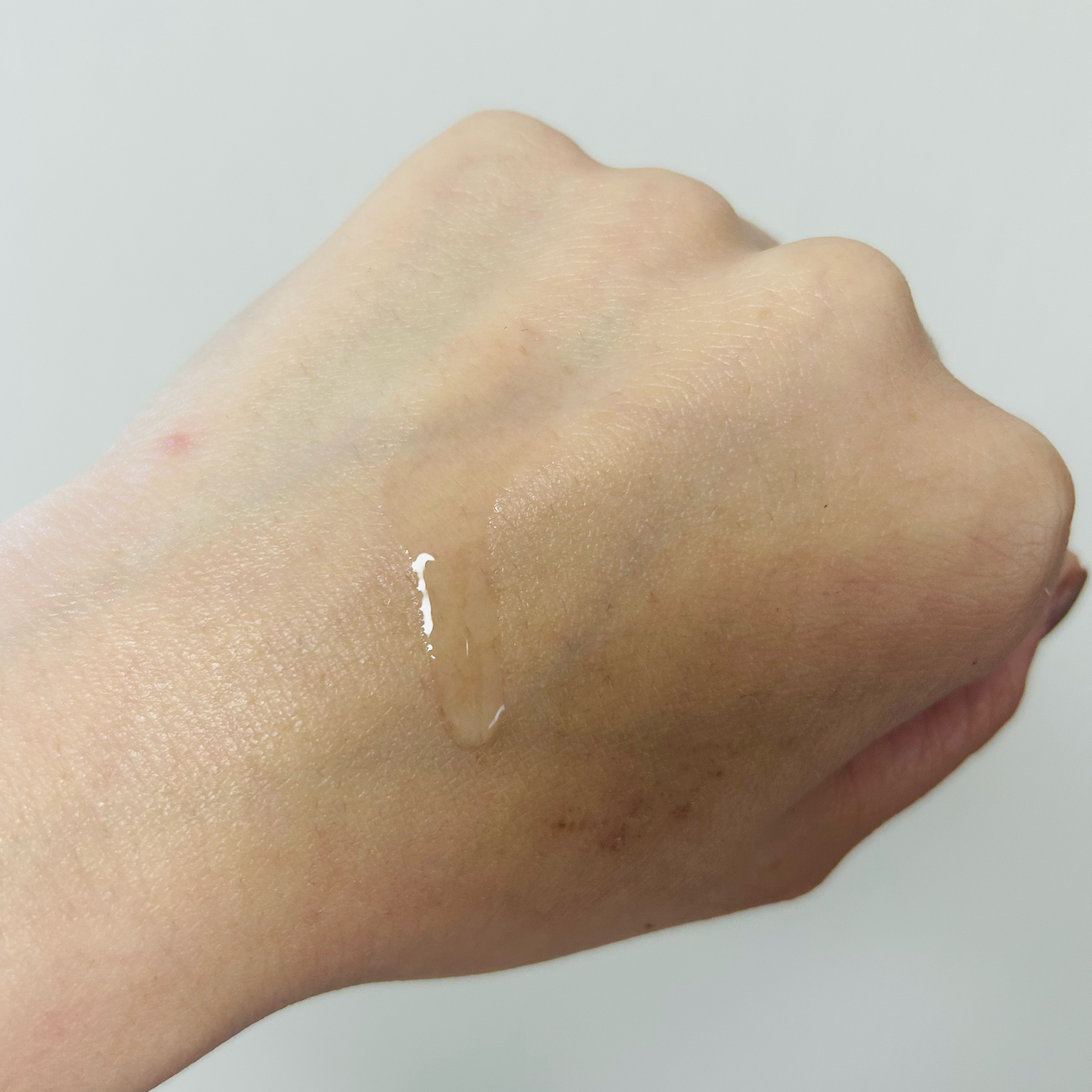 バイオイル/バイオイル/フェイスオイルを使ったクチコミ（3枚目）