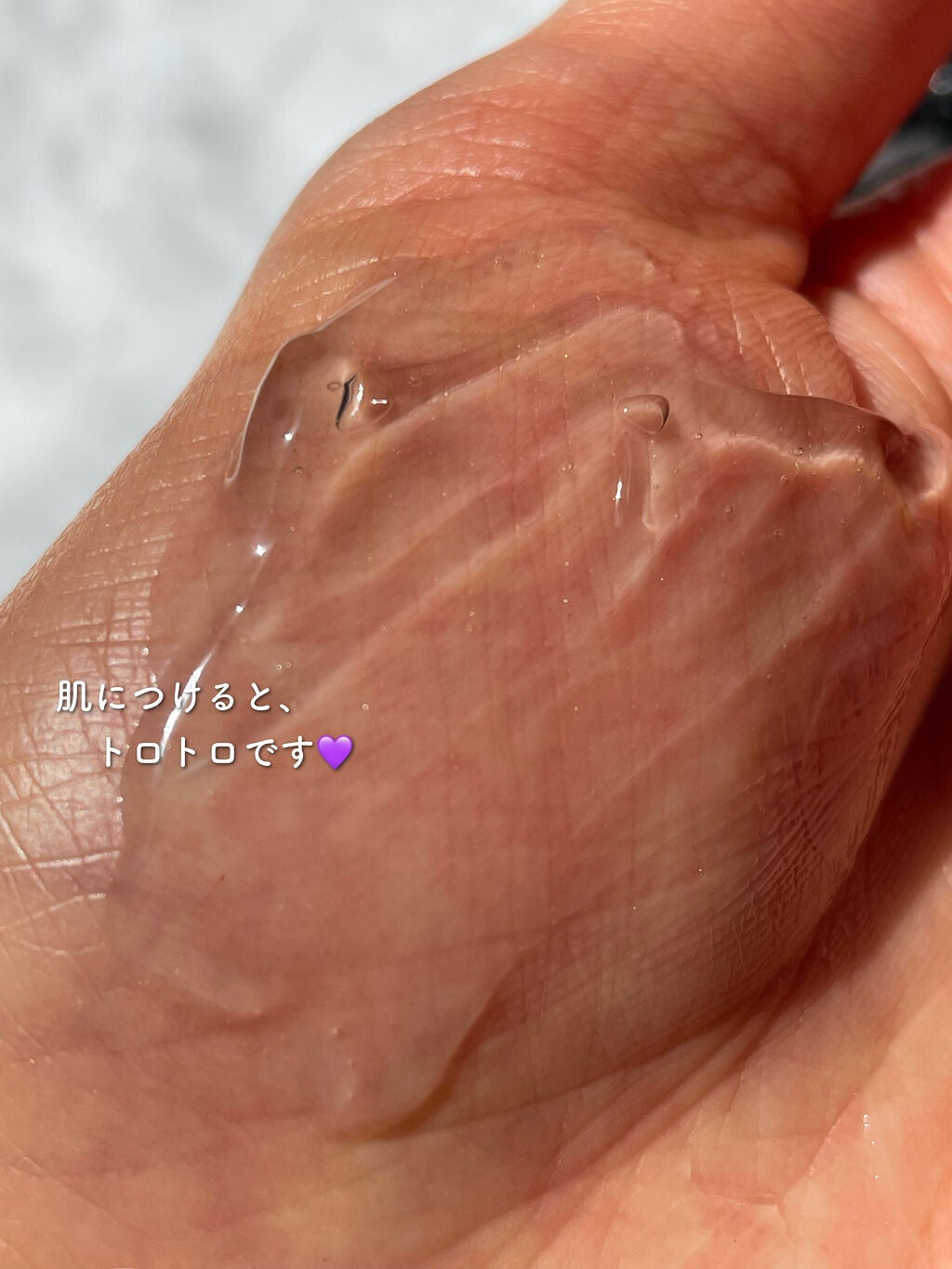 XILOCNARE/TENSHI/オールインワン化粧品を使ったクチコミ(5枚目)