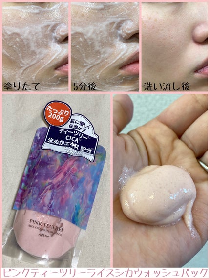 ピンクティーツリーライスシカウォッシュオフパック/APLIN/洗い流すパック・マスクを使ったクチコミ(1枚目)