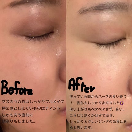 CHOIクレンジングオイル 薬用ニキビケア/肌美精/オイルクレンジングを使ったクチコミ(2枚目)