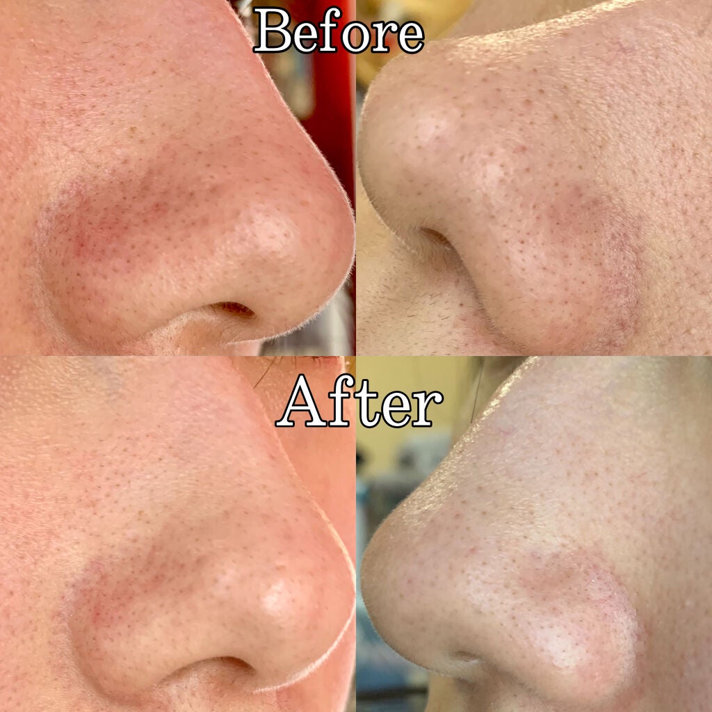 スーパーヴォルカニック ポア クレイマスク/innisfree/洗い流すパック・マスクを使ったクチコミ(3枚目)