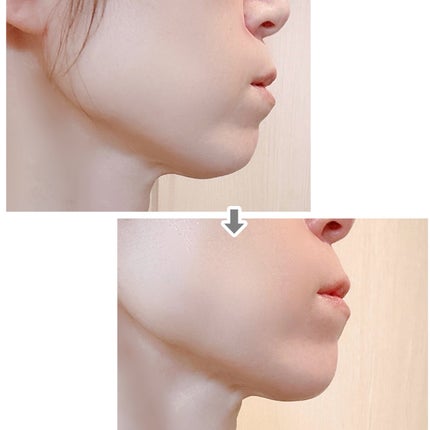 9番 NMNバイオリフトラッピングマスク/numbuzin/シートマスク・パックを使ったクチコミ(7枚目)