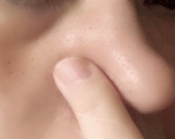 肌潤 ポアソリューション/米肌/美容液を使ったクチコミ(4枚目)