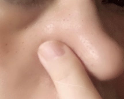 肌潤 ポアソリューション/米肌/美容液を使ったクチコミ(4枚目)