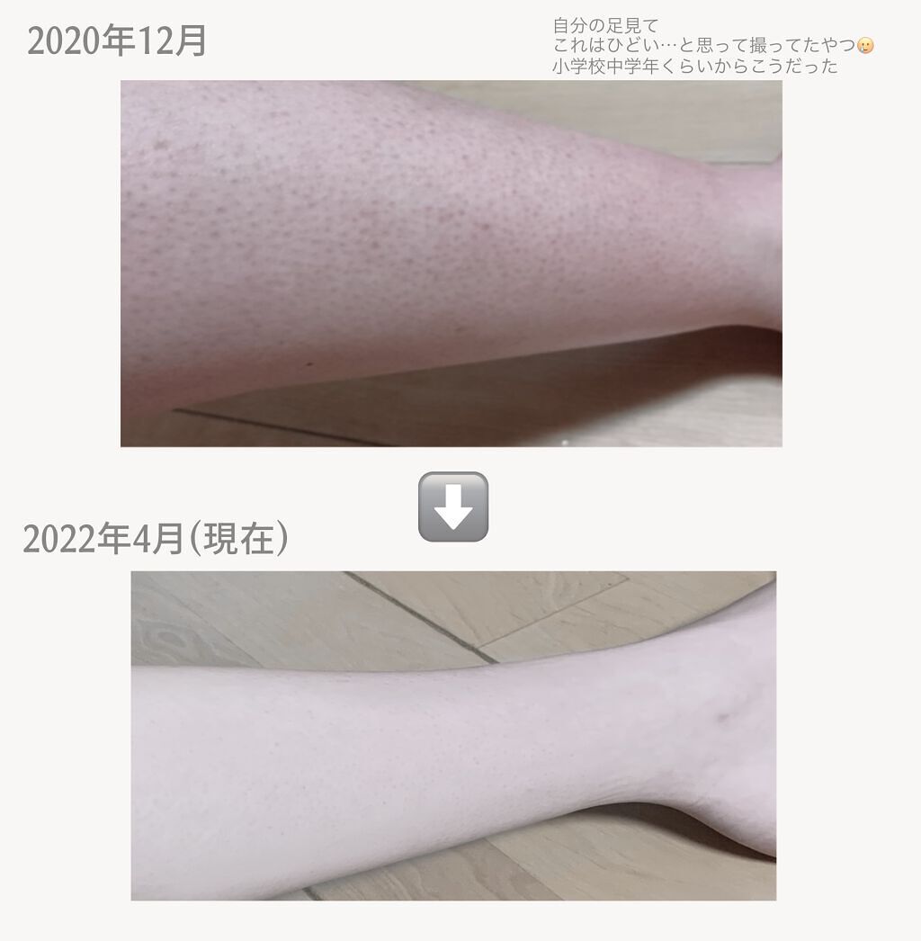 ヴィート ピュアバスタイム除毛クリーム 敏感肌用/Veet/除毛クリームを使ったクチコミ（2枚目）