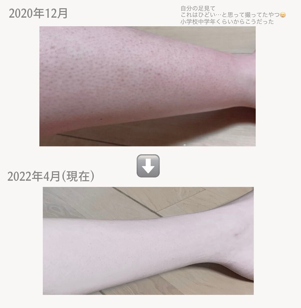 マイルド&モイスチャーアロエジェル/ネイチャーリパブリック/ボディローションを使ったクチコミ(2枚目)