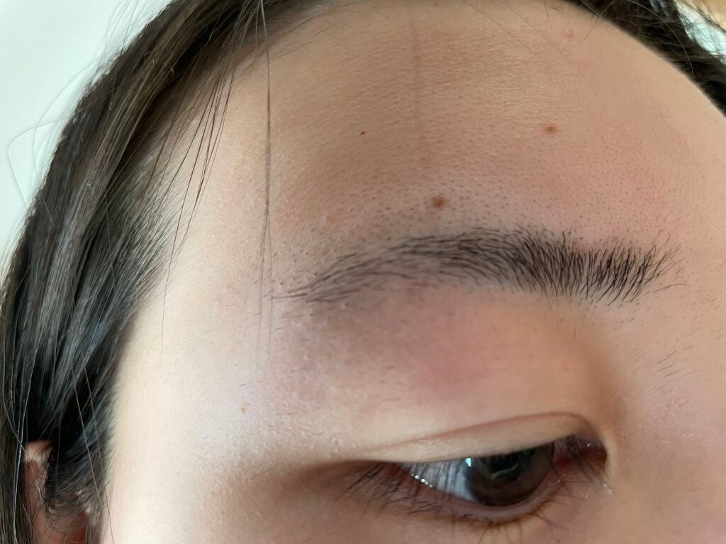 pii on LIPS 「見苦しいくてすみません😭肌の悩みを相談したくて投稿しました!さ..」(2枚目)