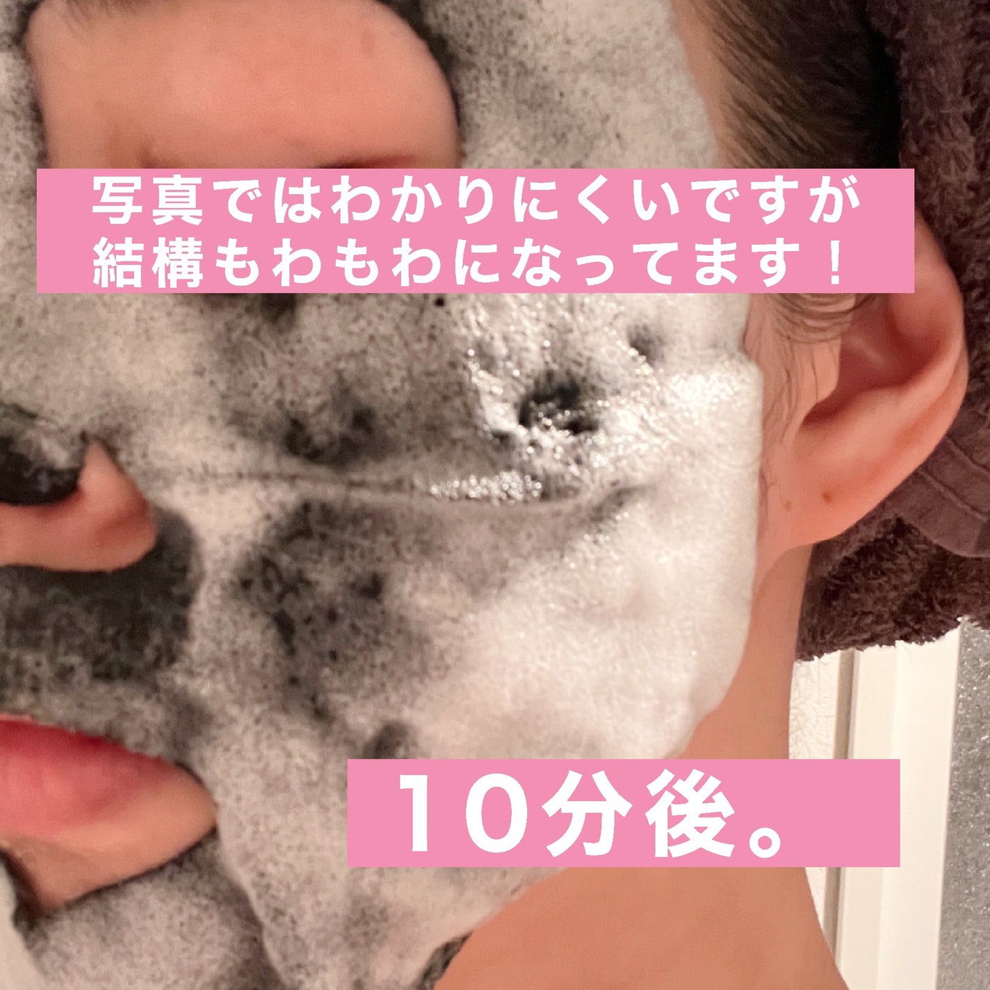 ブライトニング バブルトックス セラムマスク/MEDIHEAL/シートマスク・パックを使ったクチコミ(3枚目)