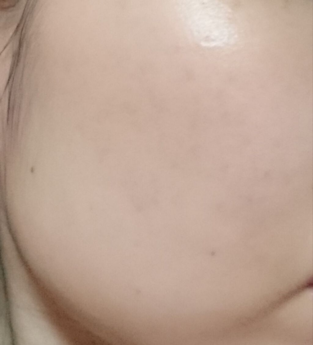 化粧水・敏感肌用・高保湿タイプ/無印良品/化粧水を使ったクチコミ(1枚目)