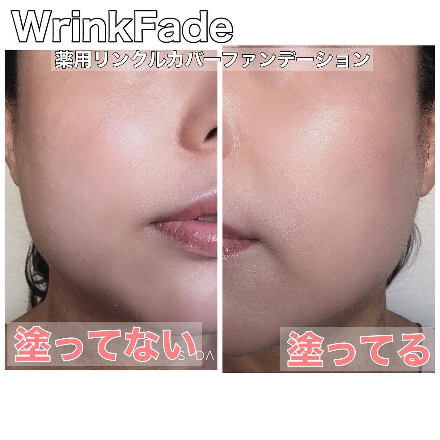 薬用リンクルカバーファンデーション〈シワ改善ファンデーション 薬用リンクルカバーファンデーション〈シワ改善ファンデーション