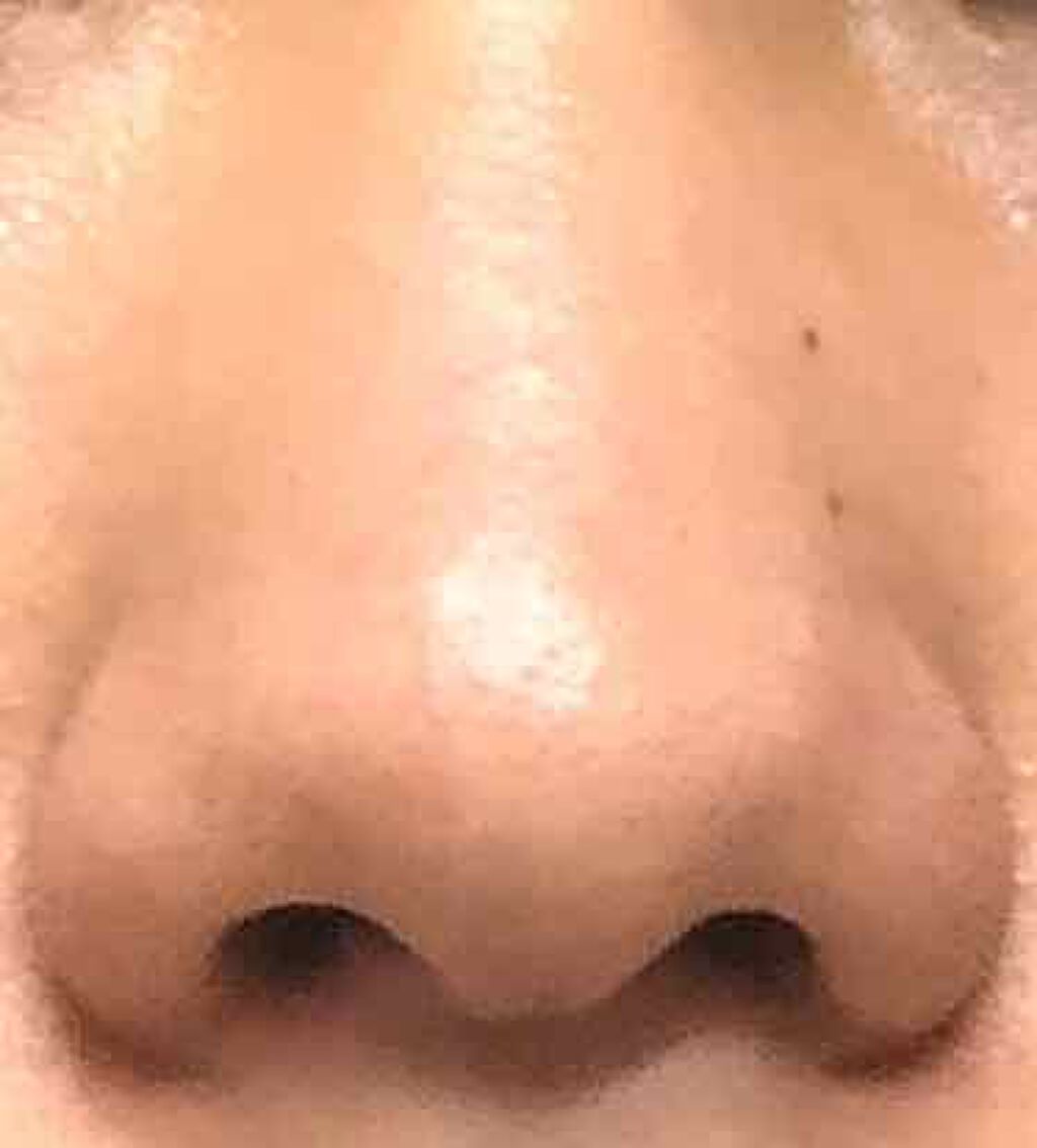 エクサージュ シーバム コントロール エッセンス EX/ALBION/美容液を使ったクチコミ（2枚目）