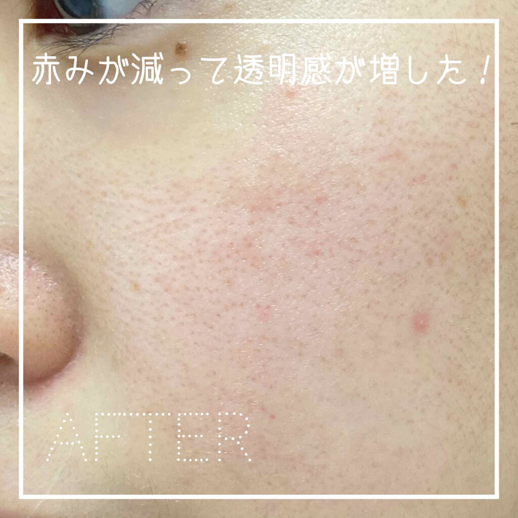 クリアウェルネス リファイニング ミルク/雪肌精/乳液を使ったクチコミ（3枚目）