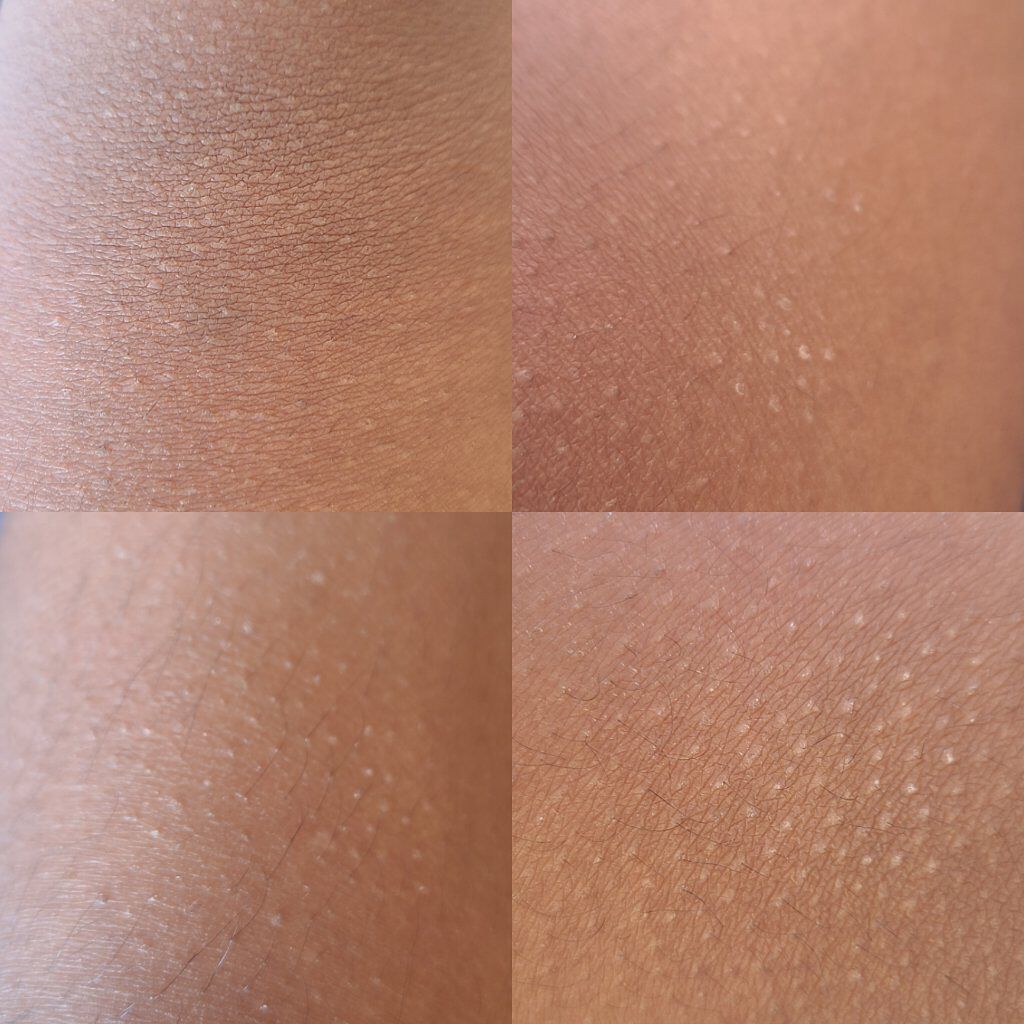 DAISO アロエ乳液のクチコミ「アロエ乳液 ダイソー 🔥辛口評価🔥

どうも！りむです
今回は、ダイソーで購入したアロエ乳液の.....」（2枚目）