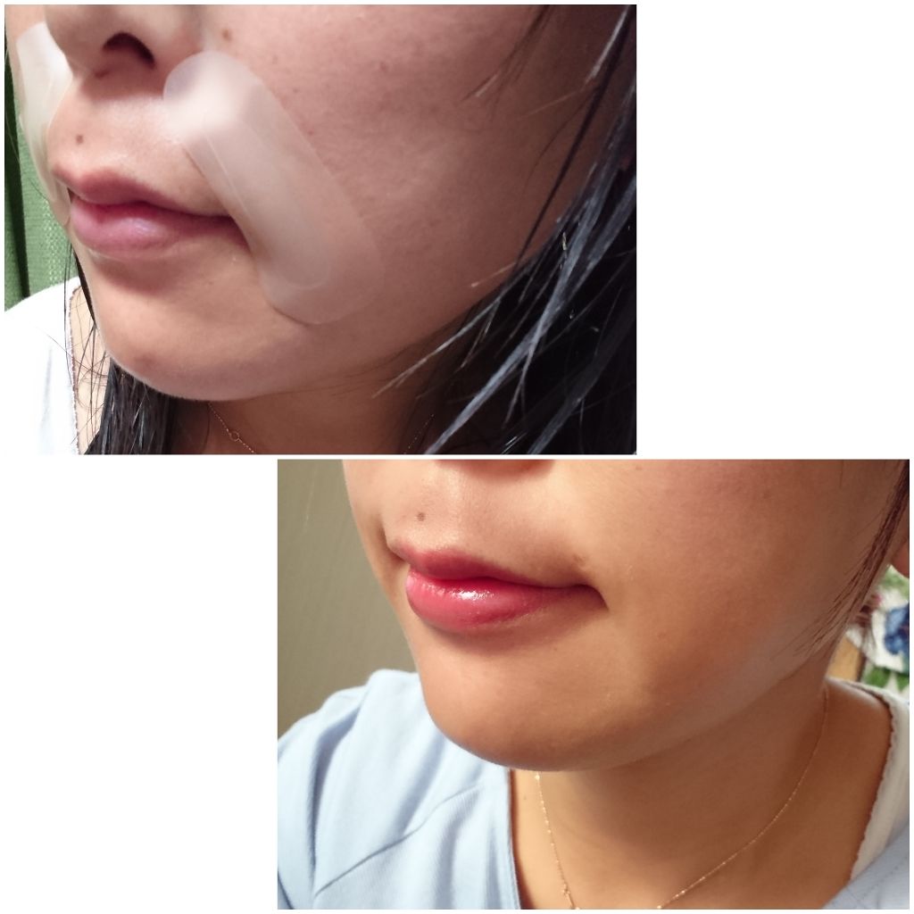 リンクルスポットマスク/クオシア/シートマスク・パックを使ったクチコミ(4枚目)