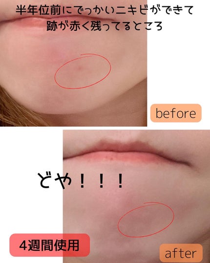 マジックカタツムリクリーム/ブラン/フェイスクリームを使ったクチコミ(4枚目)