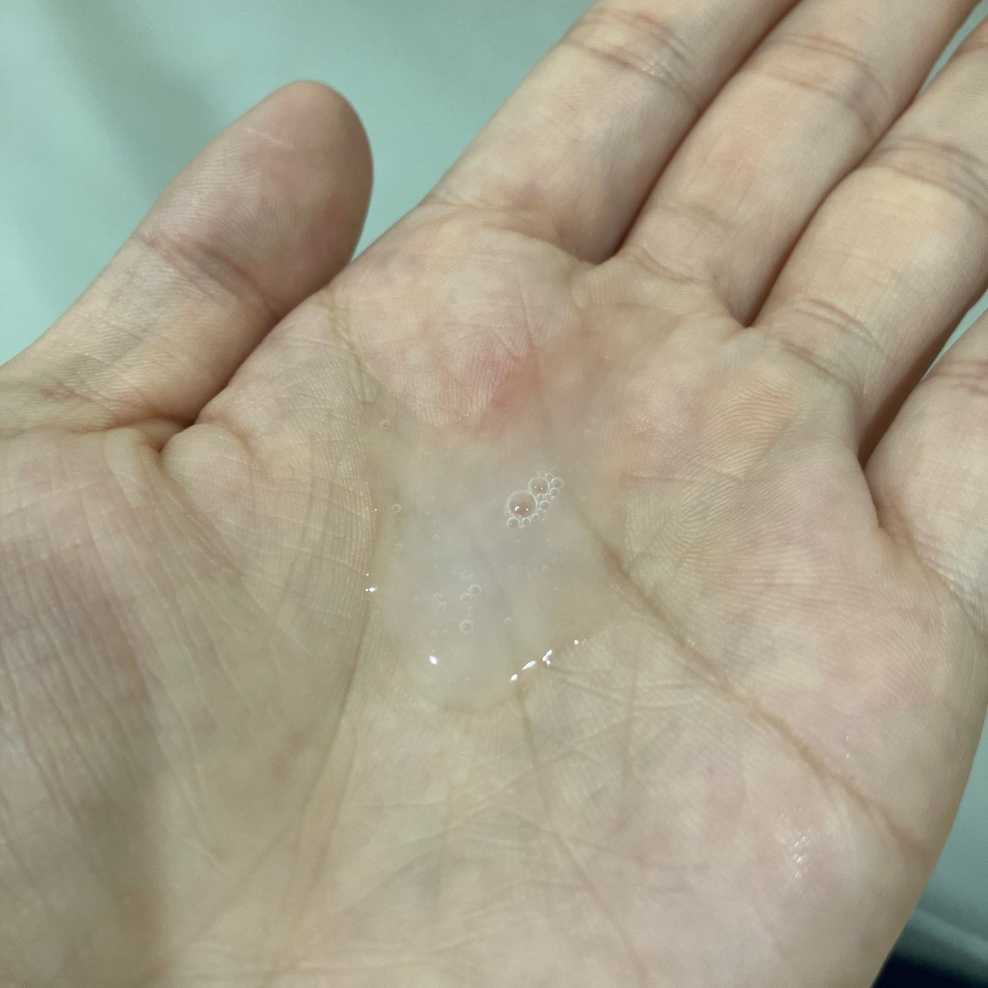 エクセルーラ クリアローション W/Excellula/化粧水を使ったクチコミ(5枚目)