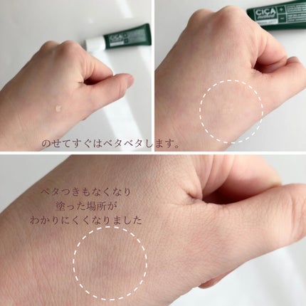 CICA method RECOVER PATCH/コジット/その他スキンケアを使ったクチコミ(3枚目)