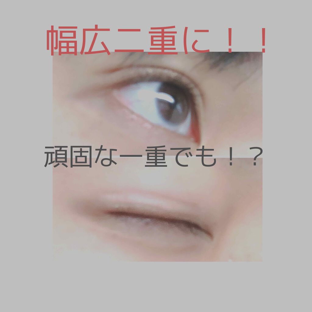 のびーるアイテープ(絆創膏タイプ、レギュラー)/DAISO/二重まぶた用アイテムを使ったクチコミ(1枚目)