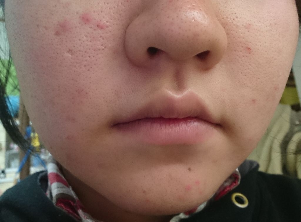 おうちdeエステ 肌をなめらかにする マッサージ洗顔ジェル/ビオレ/その他洗顔料を使ったクチコミ（3枚目）