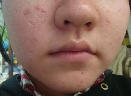 おうちdeエステ 肌をなめらかにする マッサージ洗顔ジェル/ビオレ/その他洗顔料を使ったクチコミ(3枚目)