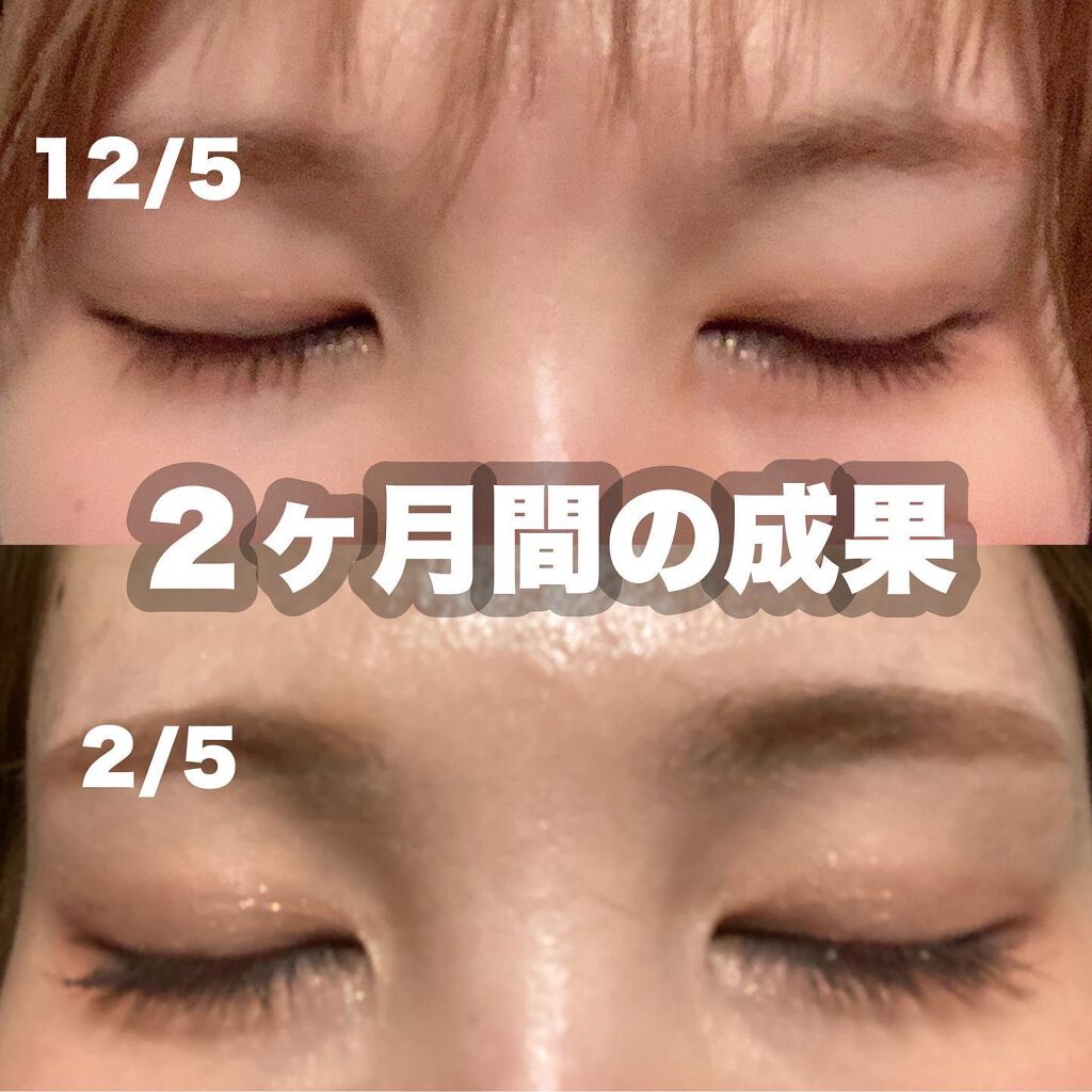 ラッシュジェリードロップ　ＥＸ/MAJOLICA MAJORCA/まつげ美容液を使ったクチコミ（2枚目）