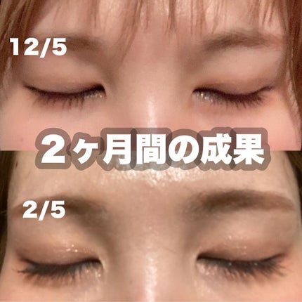 まつげ美容液(まつげ・目もと美容液)/UZU BY FLOWFUSHI/まつげ美容液を使ったクチコミ(2枚目)