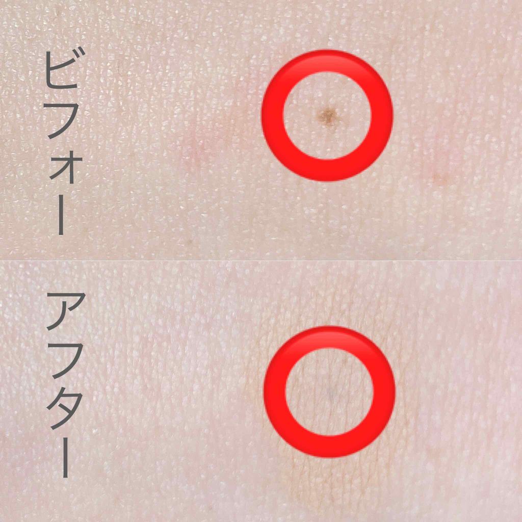 スポッツカバー ファウンデイション/SHISEIDO/クリームコンシーラーを使ったクチコミ（2枚目）