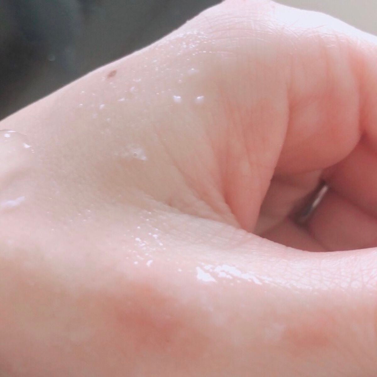 マイルドピーリングジェル/メグリッチ/ピーリングを使ったクチコミ(3枚目)