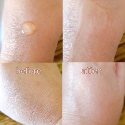 メグ on LIPS 「\マックスクリニック/お声がけ頂き今回お試しさせて頂きました🔆..」(3枚目)