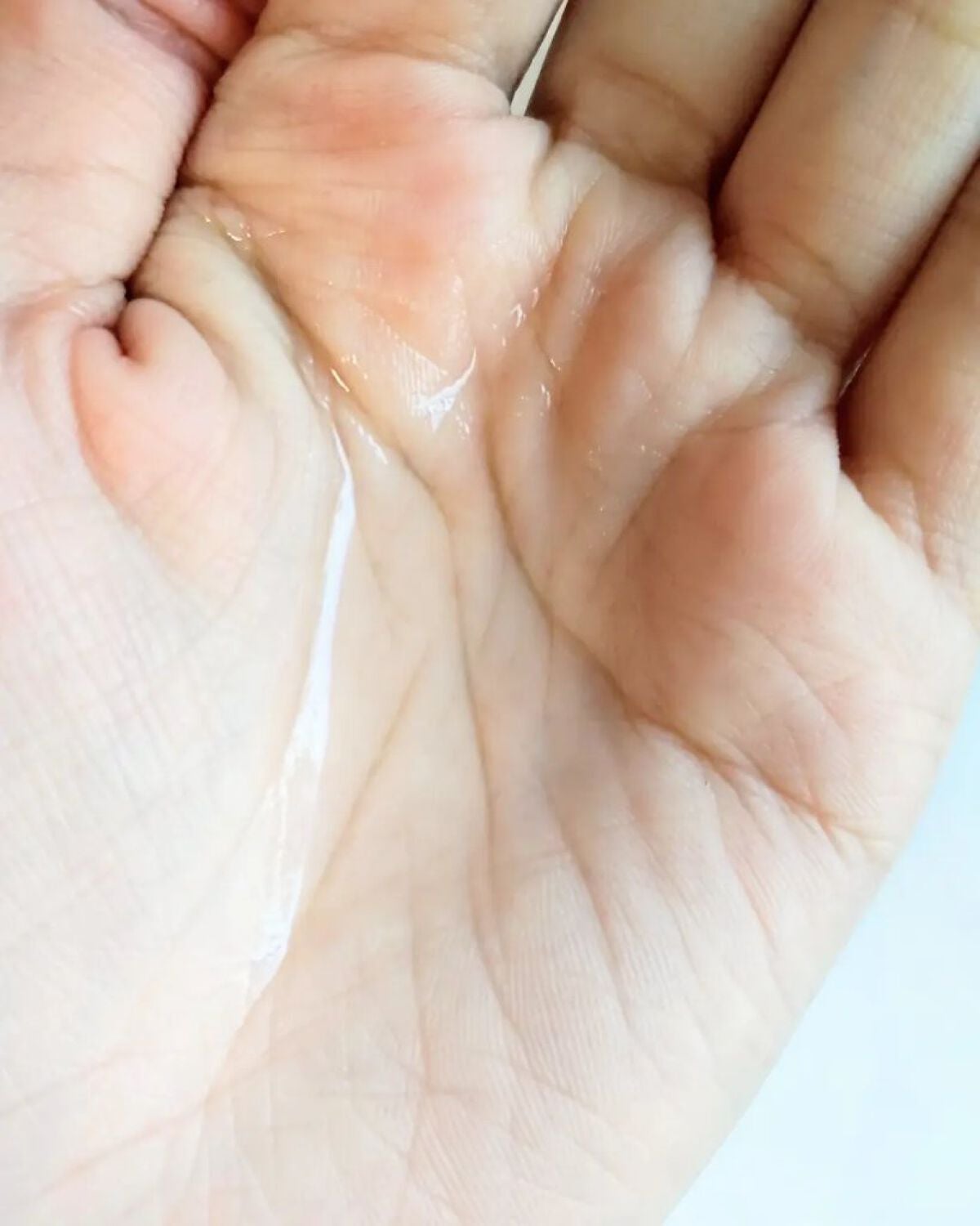 アクレオンセボエクストラクター/ANACIS/その他スキンケアを使ったクチコミ(3枚目)