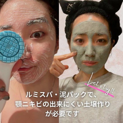 おゆみ|ニキビ・ニキビ跡ケア on LIPS 「@______ohyoume他の投稿【顎下のハリネズミを抹消し..」(5枚目)