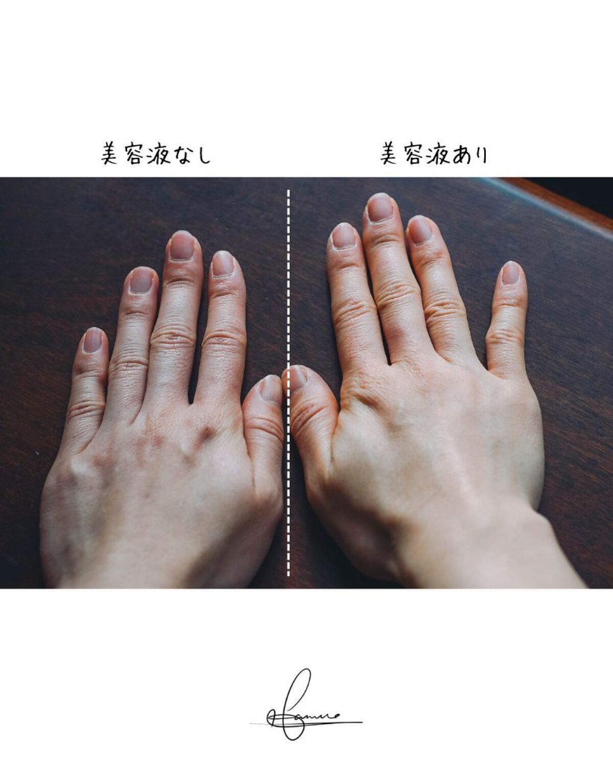 ハイジャンプ30/SISI/美容液を使ったクチコミ（3枚目）