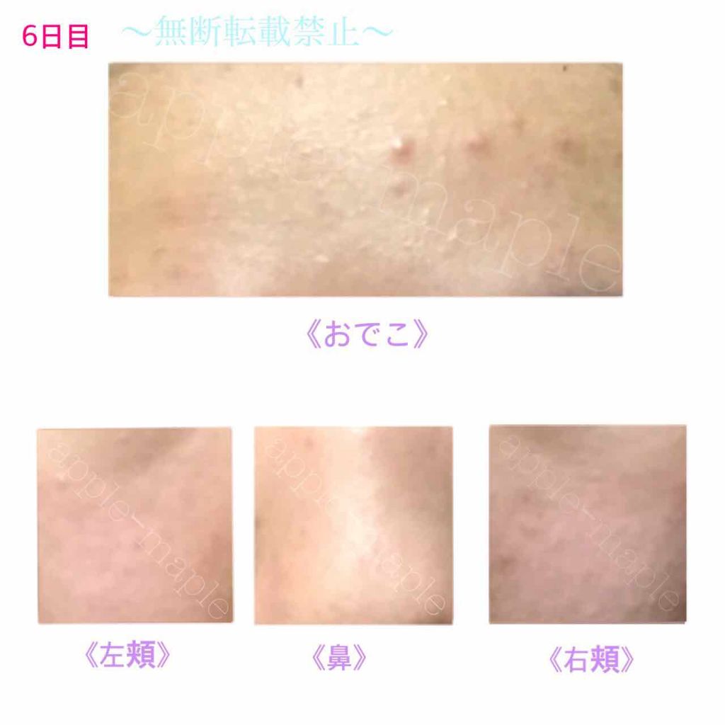 ロゼット 洗顔パスタ 荒性肌/ロゼット/洗顔フォームを使ったクチコミ(3枚目)